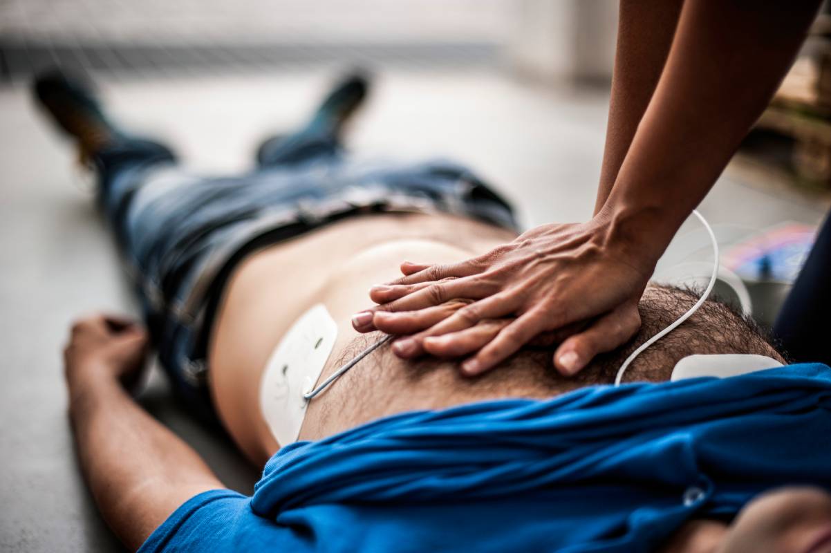 Cardiopulmonary Resuscitation