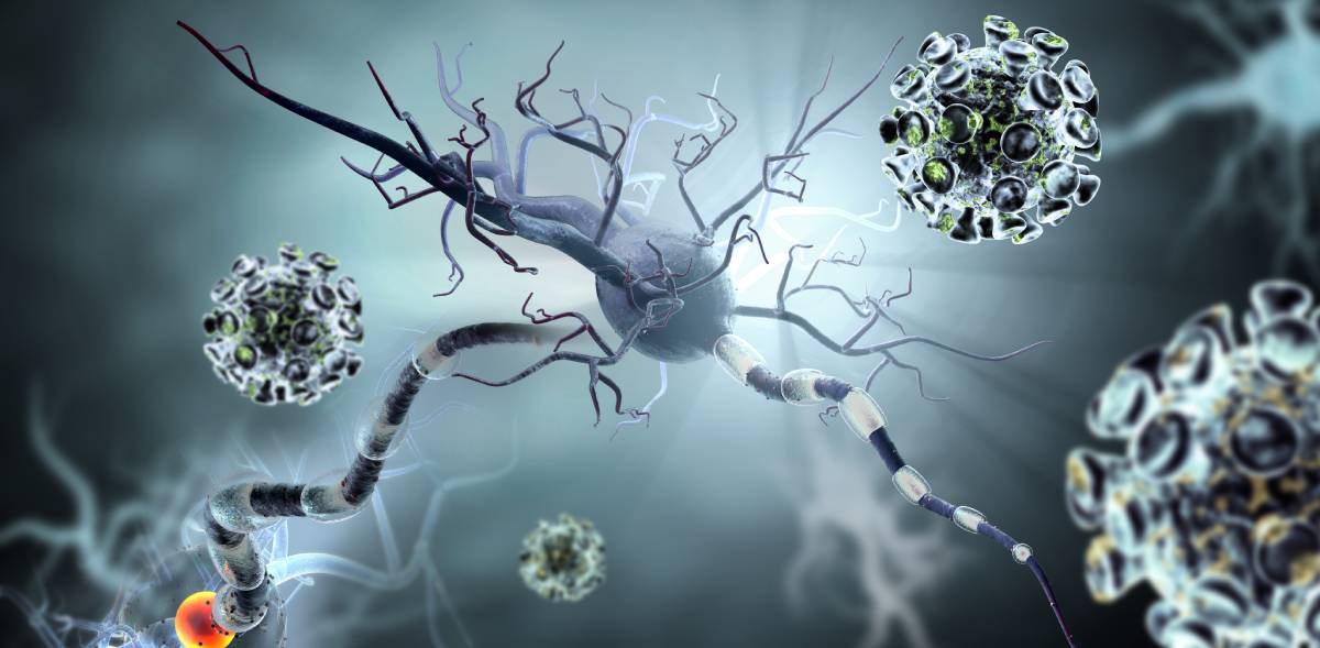Neurological Symptoms of COVID-19