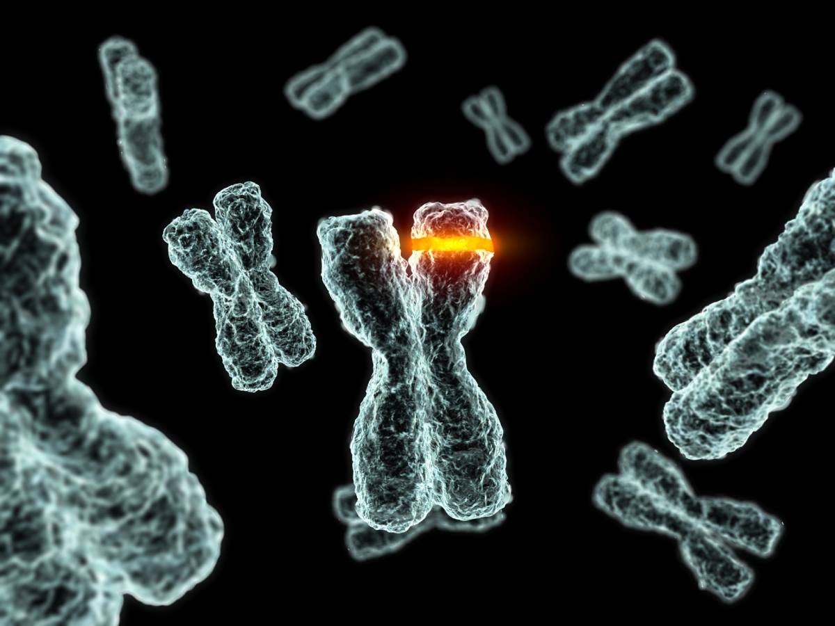 Malignant hyperthermia (MH) is a genetic skeletal muscle disorder.