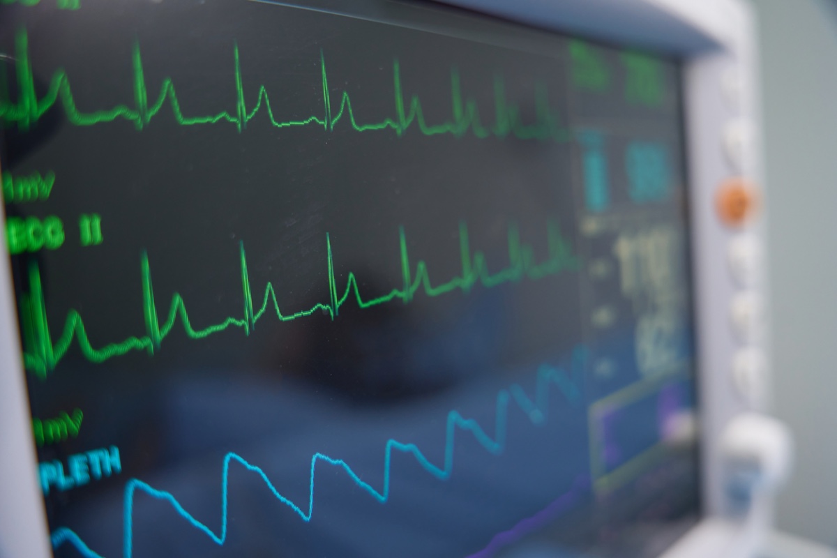 Evidence-Based Management of Cardiovascular Risk in the OR