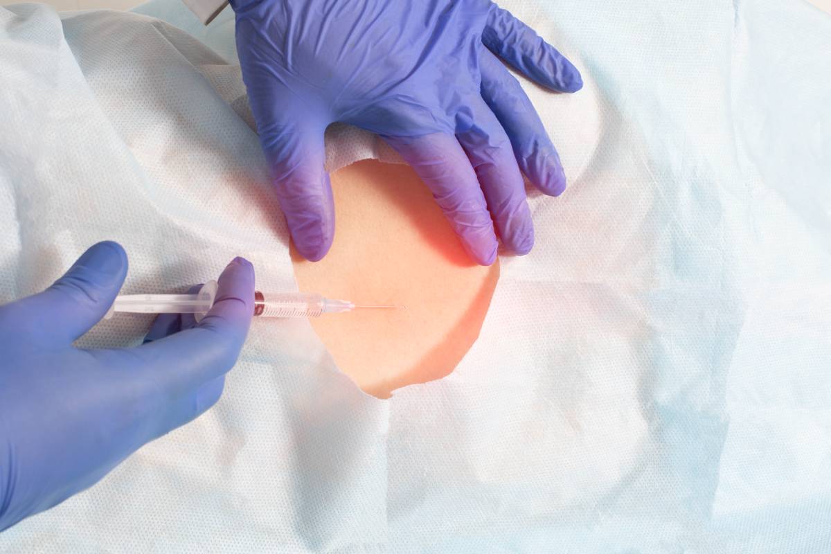 Physical Assessment of Block Level in Regional Anesthesia