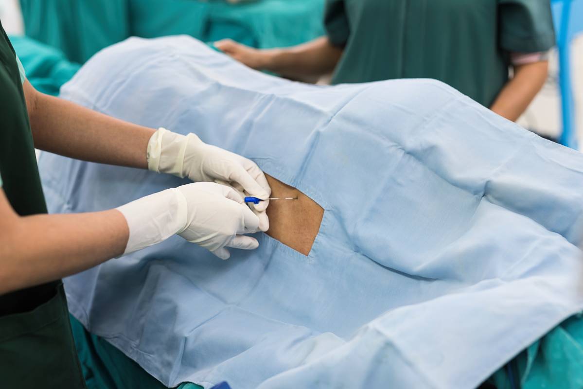 Different Types of Neuraxial Anesthesia