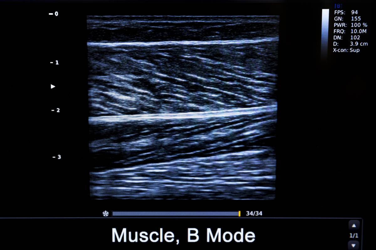 musculoskeletalultrasound